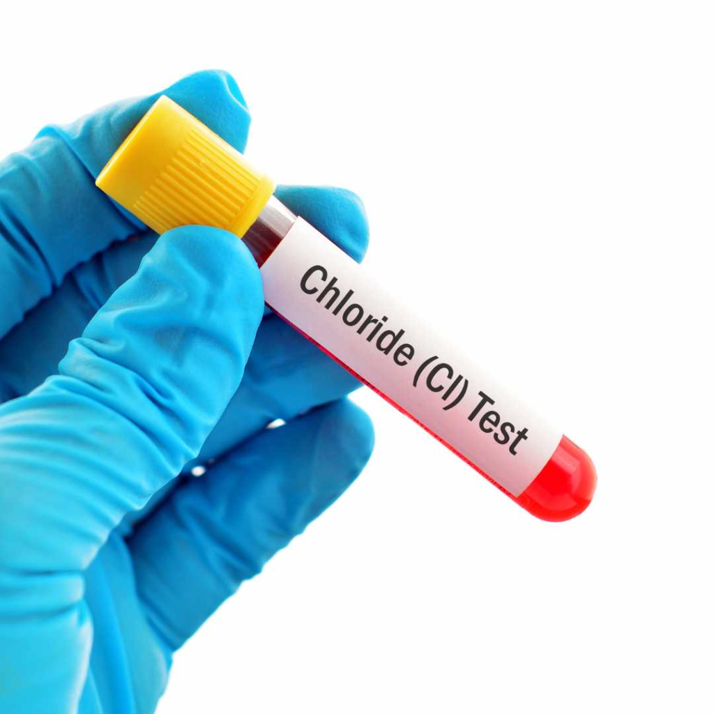 Chloride