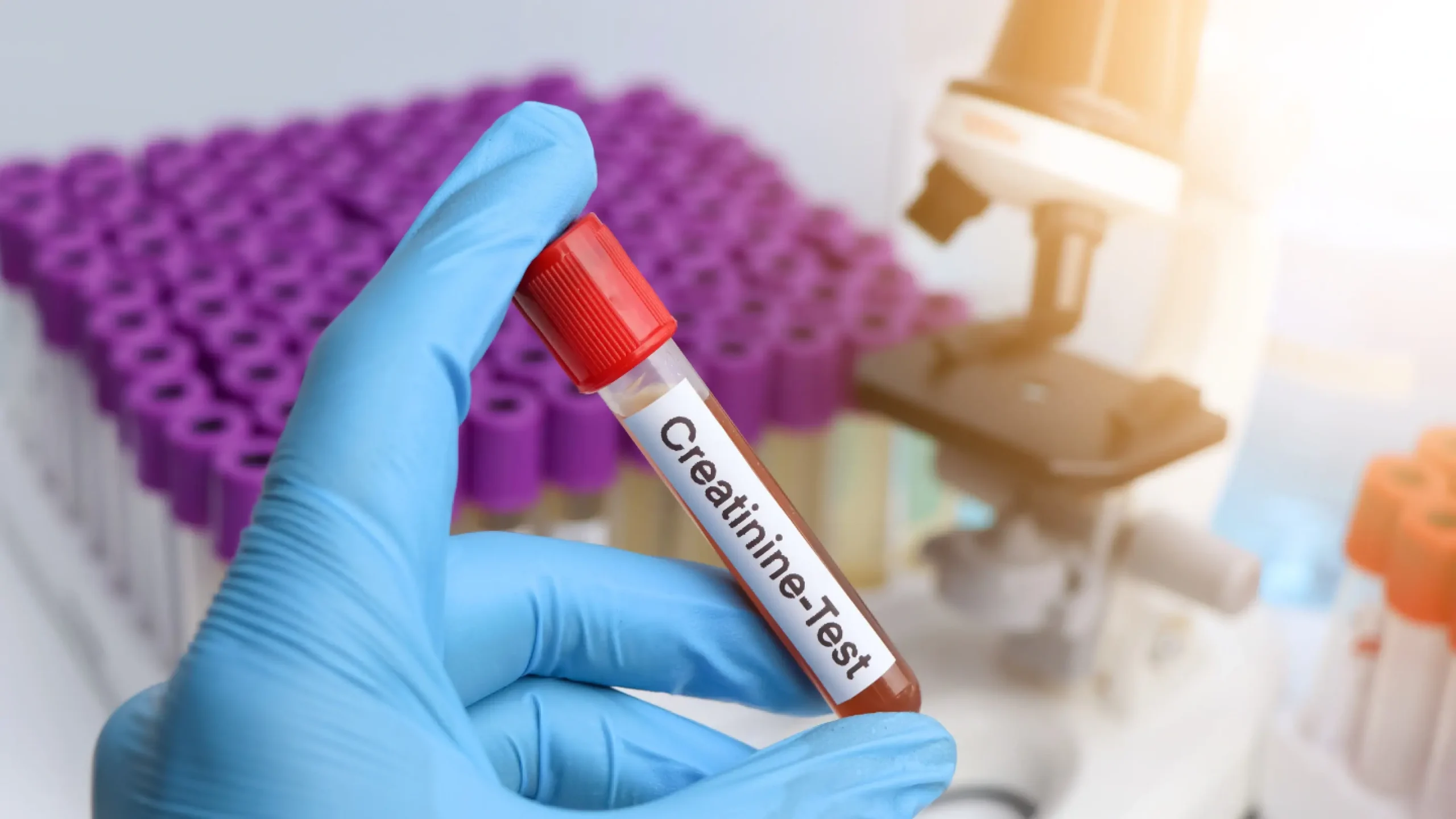 Creatinine