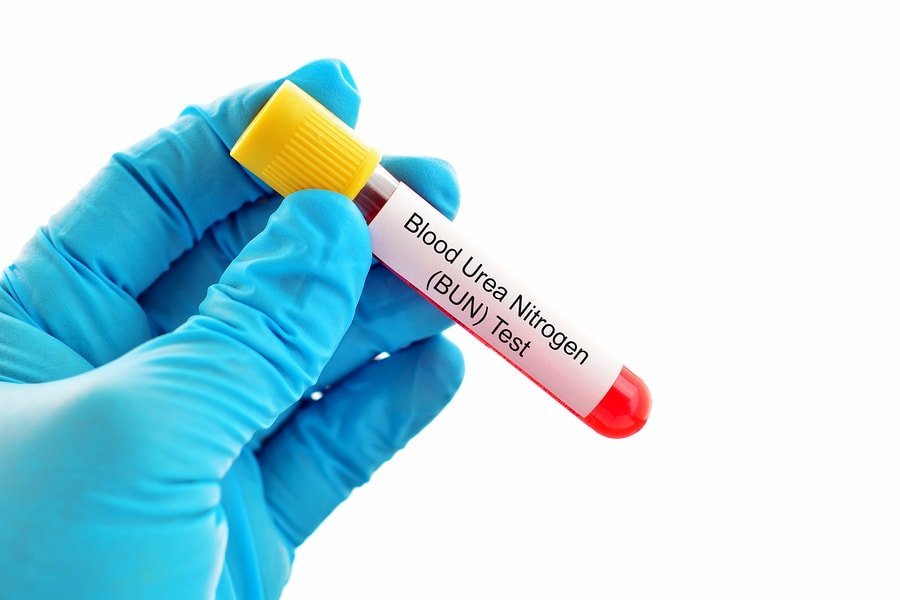 Blood Urea Nitrogen (BUN)
