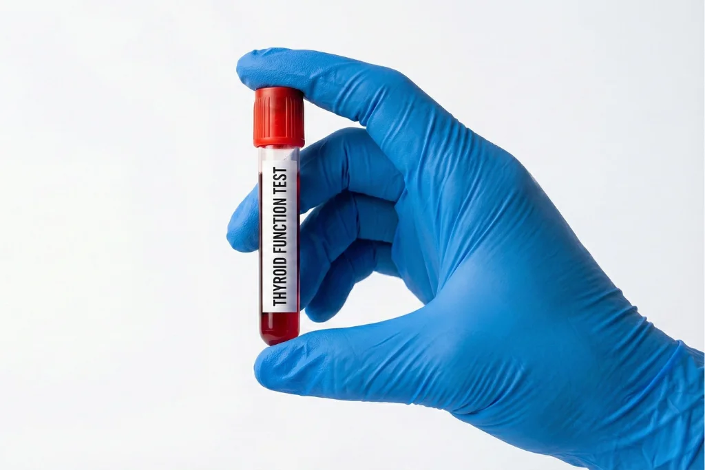 Thyroid Function Tests
