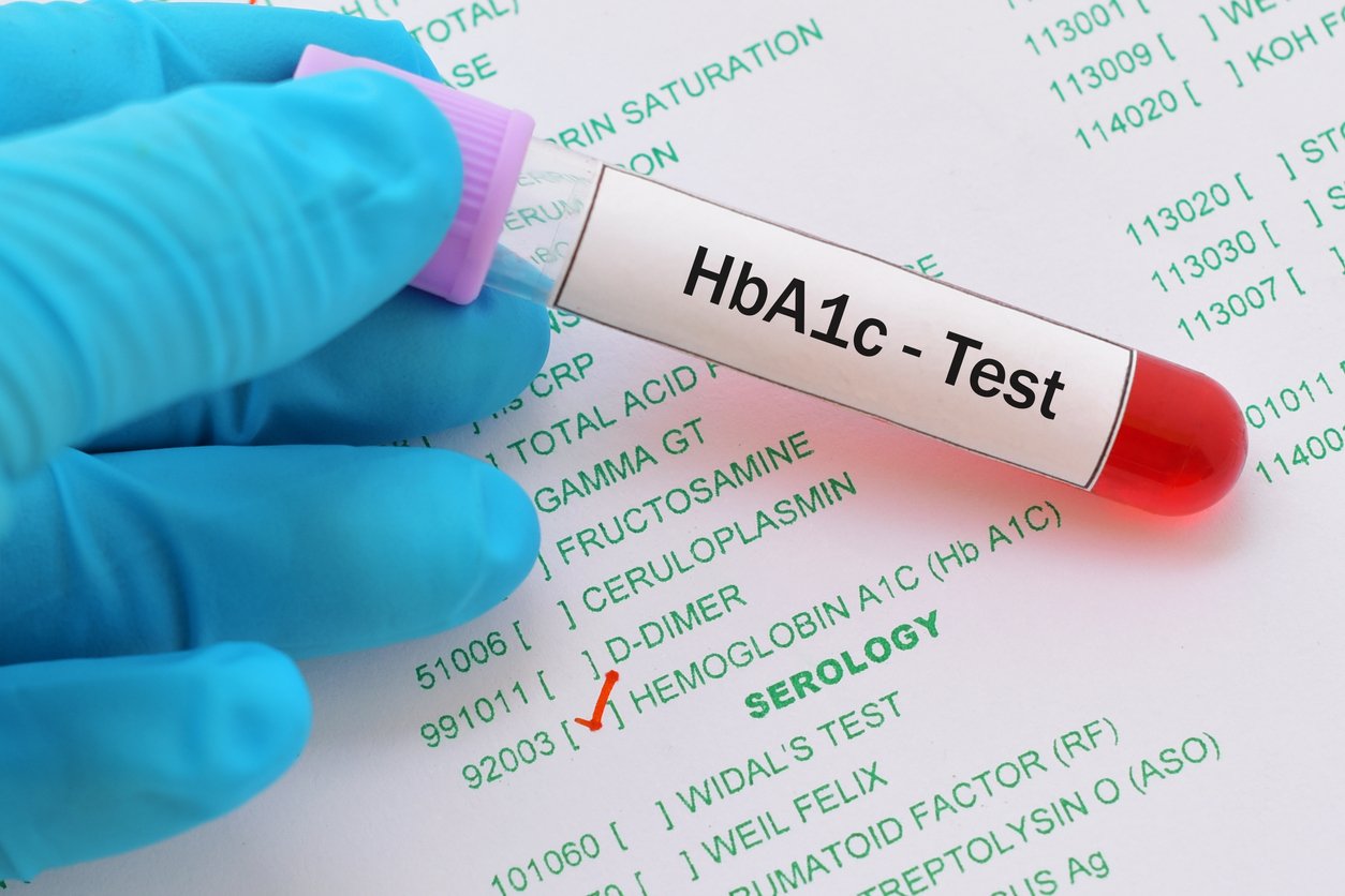 Hemoglobin A1C