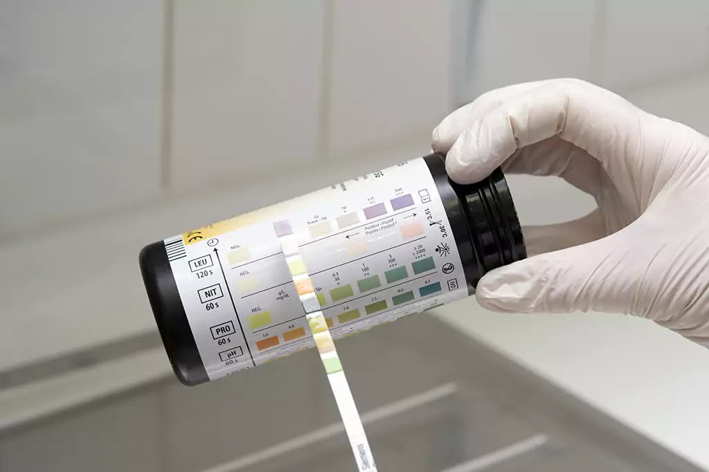 UTI Testing